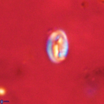 Neocrepidolithus dirimosus VR 01883