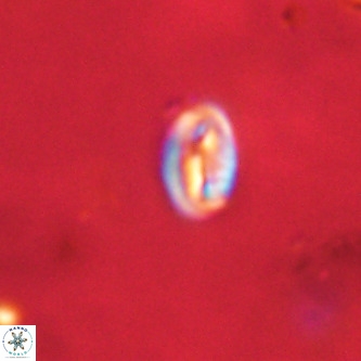 Neocrepidolithus dirimosus VR 01883