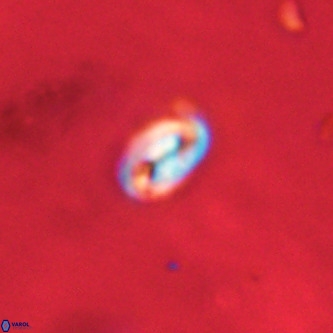 Neocrepidolithus dirimosus VR 01884