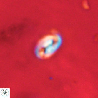 Neocrepidolithus dirimosus VR 01884