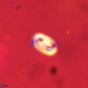 Neocrepidolithus dirimosus VR 01886