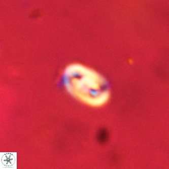 Neocrepidolithus dirimosus VR 01886