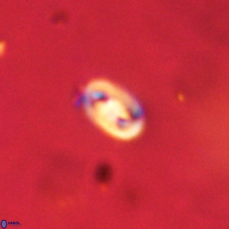 Neocrepidolithus dirimosus VR 01889