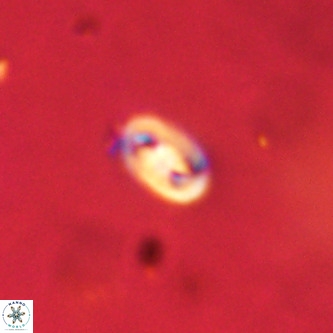 Neocrepidolithus dirimosus VR 01889