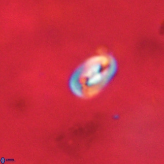 Neocrepidolithus dirimosus VR 01890