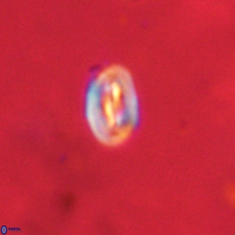 Neocrepidolithus dirimosus VR 01893