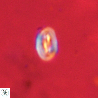 Neocrepidolithus dirimosus VR 01893