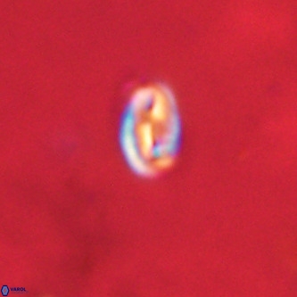 Neocrepidolithus dirimosus VR 01894