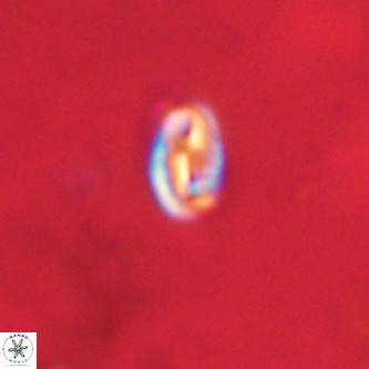Neocrepidolithus dirimosus VR 01894