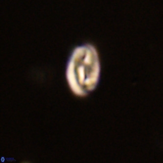 Neocrepidolithus dirimosus VR 01895