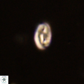 Neocrepidolithus dirimosus VR 01895