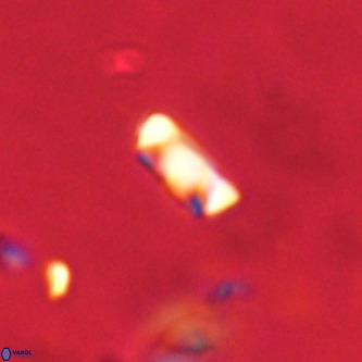 Neocrepidolithus dirimosus VR 01898