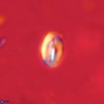 Neocrepidolithus dirimosus VR 01900