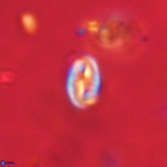 Neocrepidolithus dirimosus VR 01902