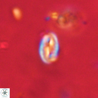 Neocrepidolithus dirimosus VR 01902