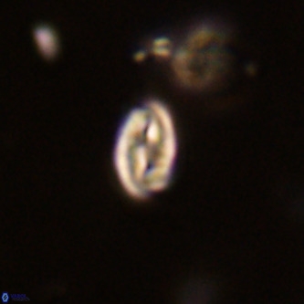 Neocrepidolithus dirimosus VR 01903