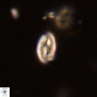 Neocrepidolithus dirimosus VR 01903