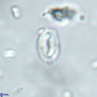 Neocrepidolithus dirimosus VR 01904