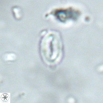 Neocrepidolithus dirimosus VR 01904