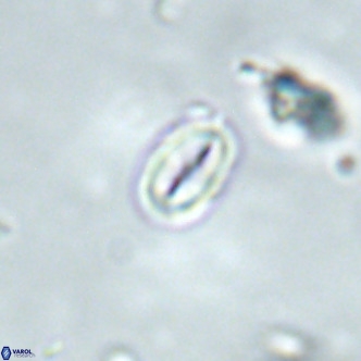 Neocrepidolithus dirimosus VR 01905