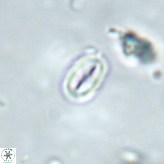 Neocrepidolithus dirimosus VR 01905