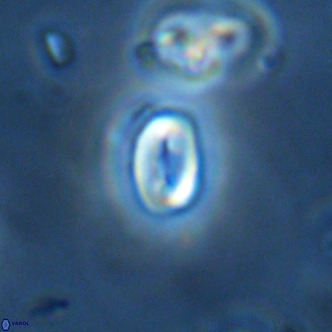 Neocrepidolithus dirimosus VR 01906