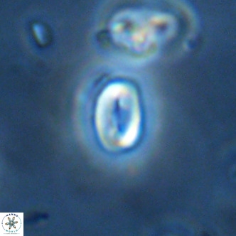 Neocrepidolithus dirimosus VR 01906