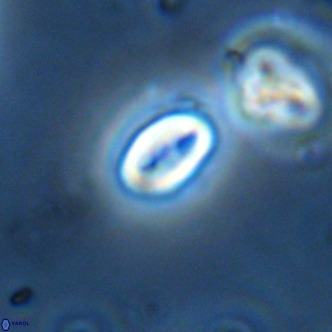 Neocrepidolithus dirimosus VR 01907