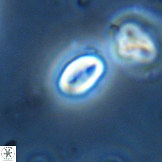 Neocrepidolithus dirimosus VR 01907