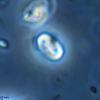 Neocrepidolithus dirimosus VR 01908