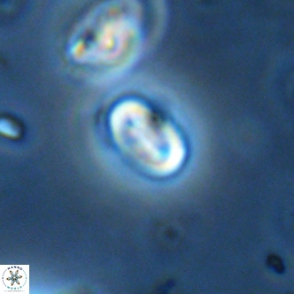 Neocrepidolithus dirimosus VR 01908