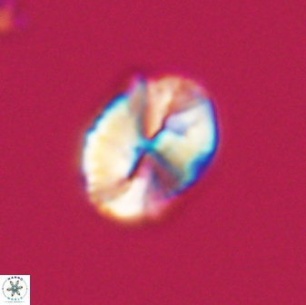 Neocrepidolithus fossus 22877