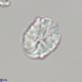 Neocrepidolithus fossus 22879