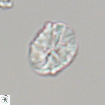 Neocrepidolithus fossus 22879