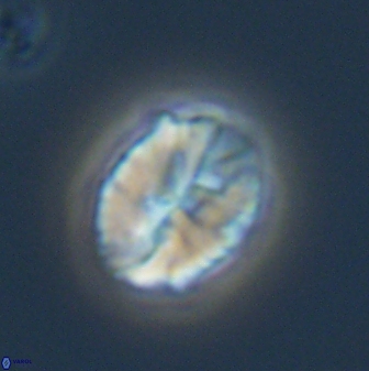 Neocrepidolithus fossus 22880