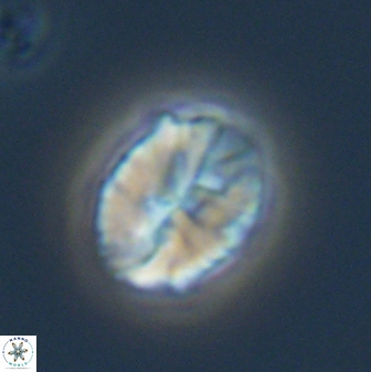 Neocrepidolithus fossus 22880