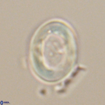 Neocrepidolithus grandiculus 20319