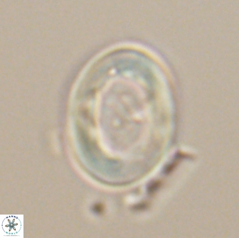 Neocrepidolithus grandiculus 20319