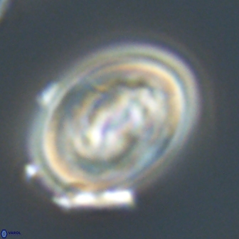 Neocrepidolithus grandiculus 20325