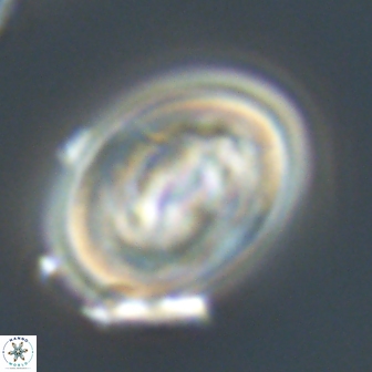 Neocrepidolithus grandiculus 20325