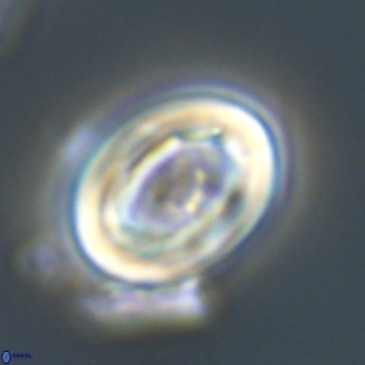 Neocrepidolithus grandiculus 20326