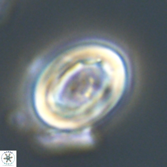 Neocrepidolithus grandiculus 20326