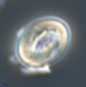 Neocrepidolithus grandiculus 20327