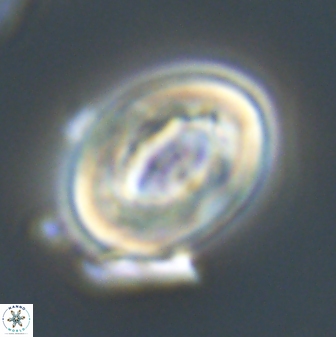 Neocrepidolithus grandiculus 20327