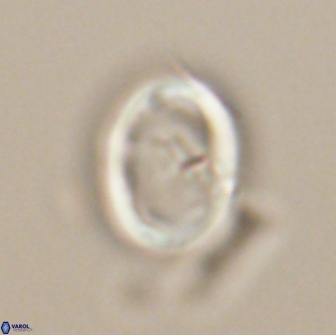 Neocrepidolithus grandiculus 20320