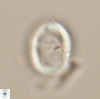 Neocrepidolithus grandiculus 20320