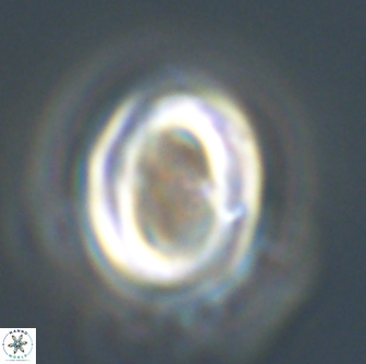 Neocrepidolithus grandiculus 20322