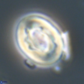 Neocrepidolithus grandiculus 20323