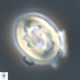 Neocrepidolithus grandiculus 20323