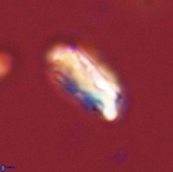 Neocrepidolithus grandiculus 43986